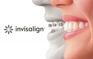 Invisalign Doctor Login