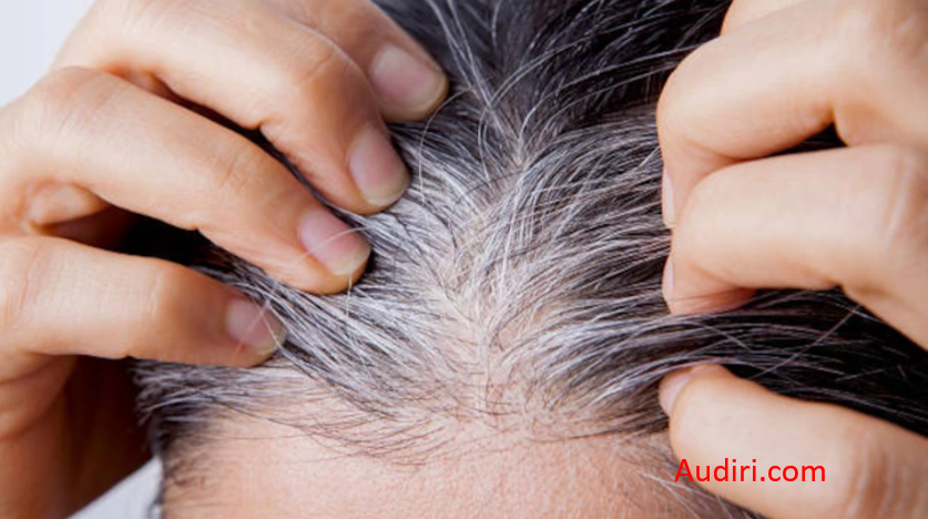 wellhealthorganic.com /know-the-causes-of-white-hair-and-easy-ways-to-prevent-it-naturally